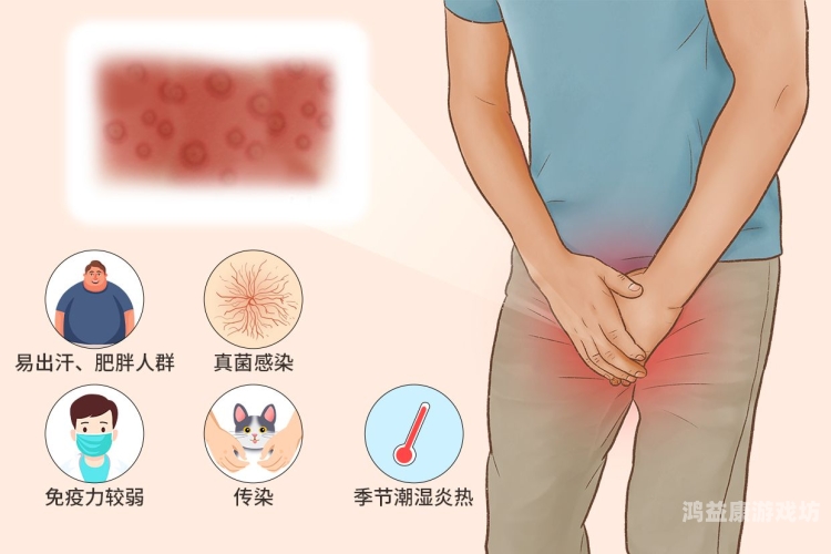 如何判断是股癣还是阴囊湿疹如何准确区分股癣与阴囊湿疹，症状、原因及治疗方法详解