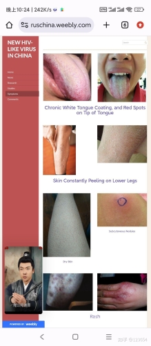 艾滋病多久能检查出来艾滋病究竟多久能检查出来？