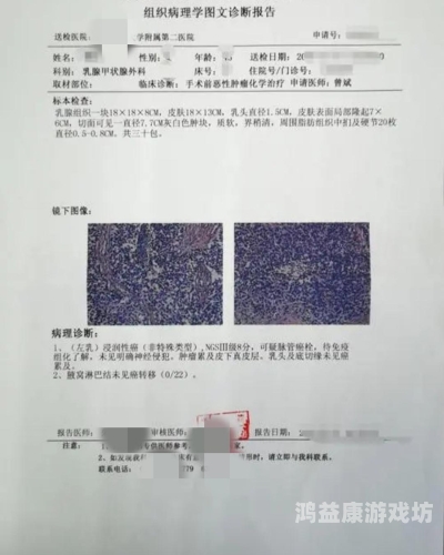 体检无异常1年半后确诊癌症晚期，体检真的能完全信任吗？