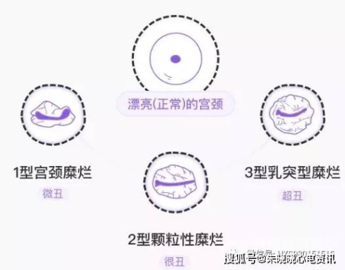 舔吸乳头操免费视频，解锁女性水蜜桃在线播放新姿势
