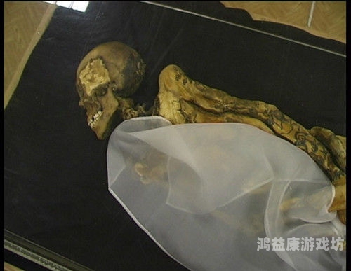 gyno日本妇科检查视频，探索女性水蜜桃在线播放的新视角日本妇科诊查