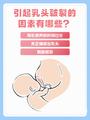 日本三级吃奶头添泬日本三级文化新风潮，乳头添泬现象的深度解析